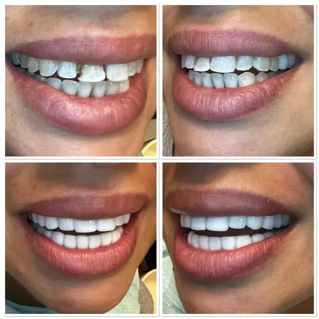 Clinical case photograph 1 from the ASDC smile gallery