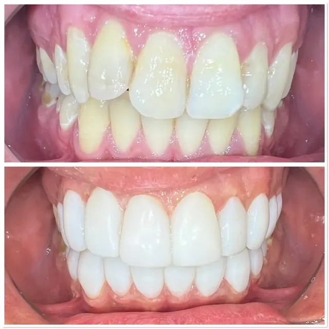 Clinical case photograph 10 from the ASDC smile gallery
