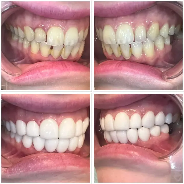 Clinical case photograph 12 from the ASDC smile gallery