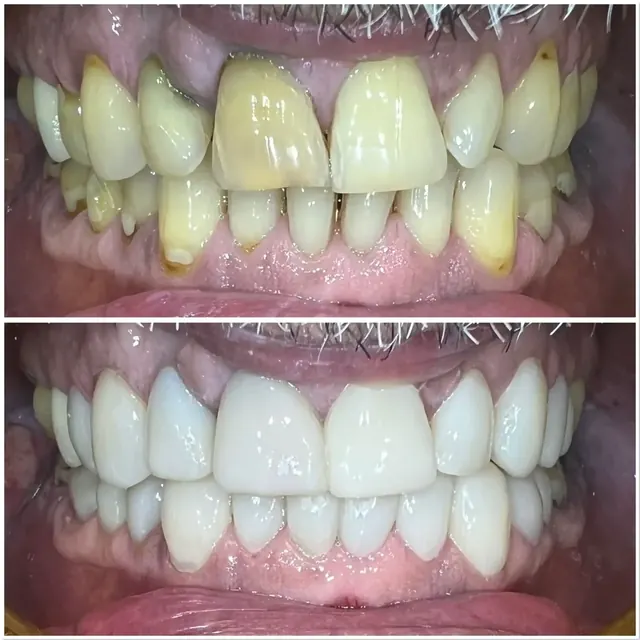 Clinical case photograph 2 from the ASDC smile gallery