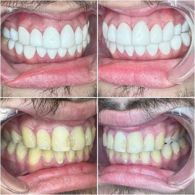 Clinical case photograph 5 from the ASDC smile gallery