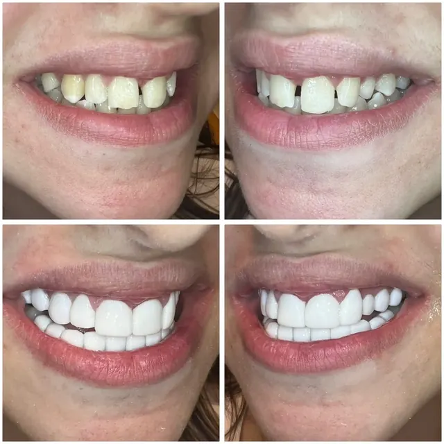 Clinical case photograph 6 from the ASDC smile gallery