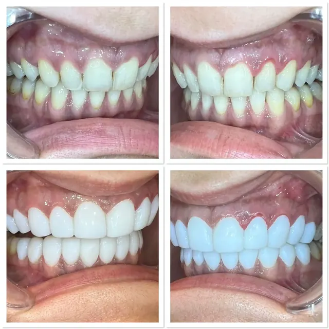 Clinical case photograph 7 from the ASDC smile gallery