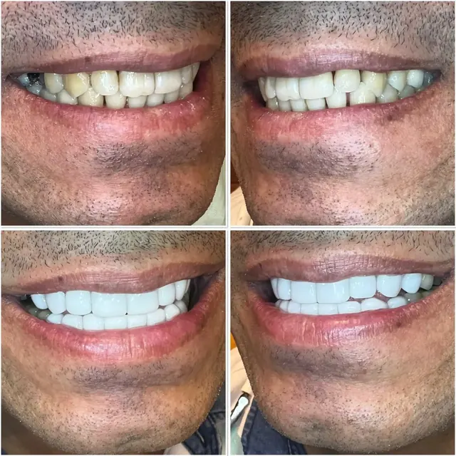 Clinical case photograph 9 from the ASDC smile gallery